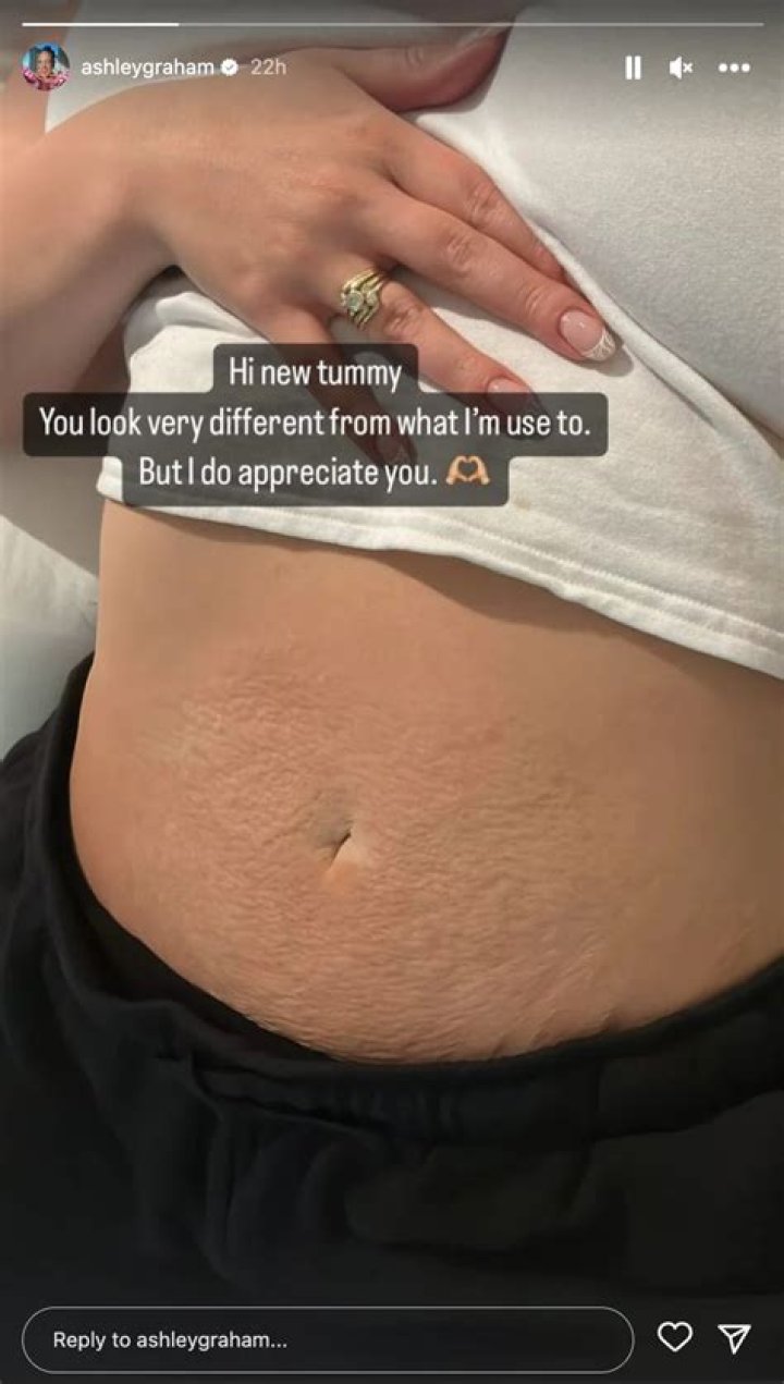
Ashley Graham Says She’s Appreciative of Her ‘New Tummy’ Nearly 10 Months After Welcoming Twins 