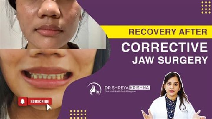 Can an overshot jaw correct itself?
