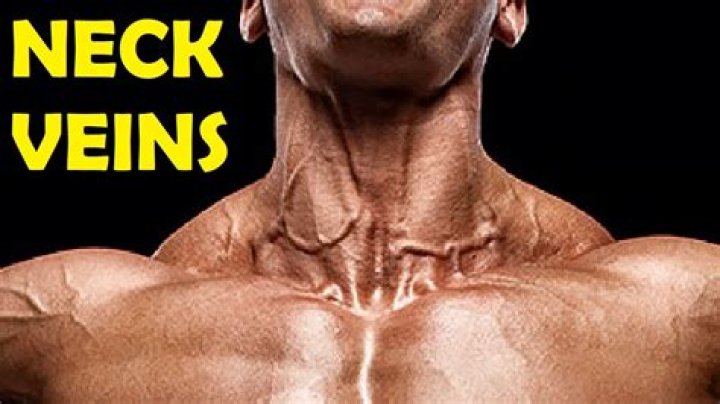 Can babies get crooks in their necks?