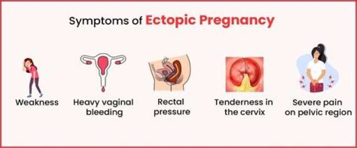 Can ectopic pregnancy survive?