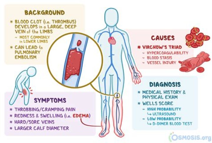 Can embolism cause death?