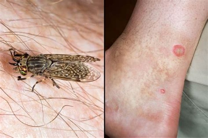 Can horsefly bites get infected?