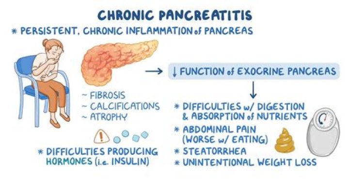 Can pancreatitis cause joint pain?