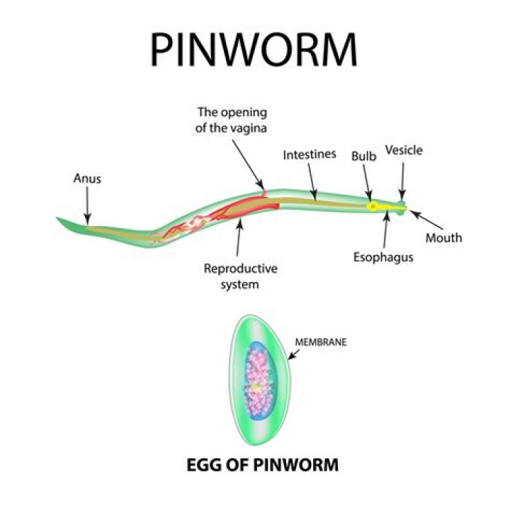 Can pinworms be seen?
