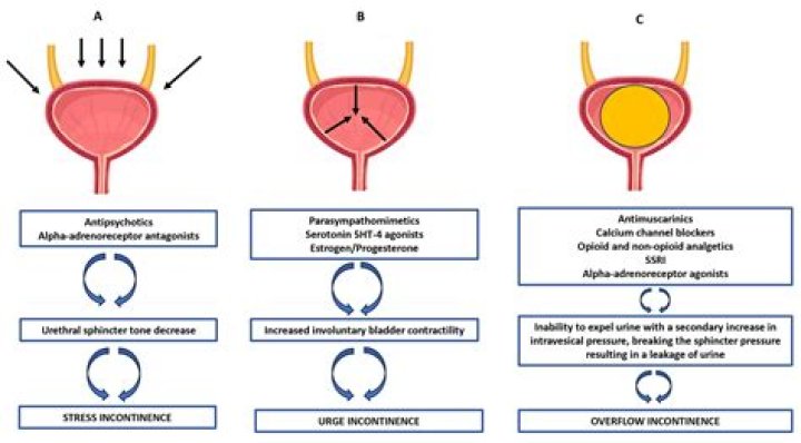 Can vesicare cause urinary retention?