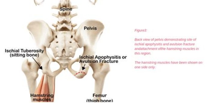 Can you feel your ischial spines?