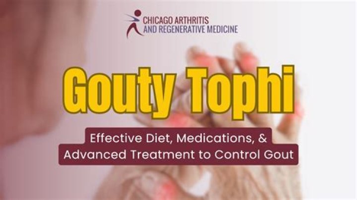 Can you remove gout tophi?