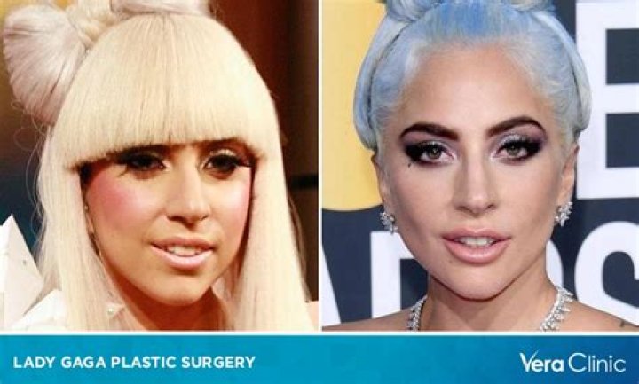 Cat Lady Plastic Surgery Before And After: What Happened To Her Face?
