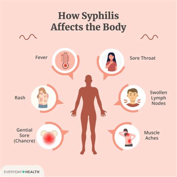 Could syphilis kill you?