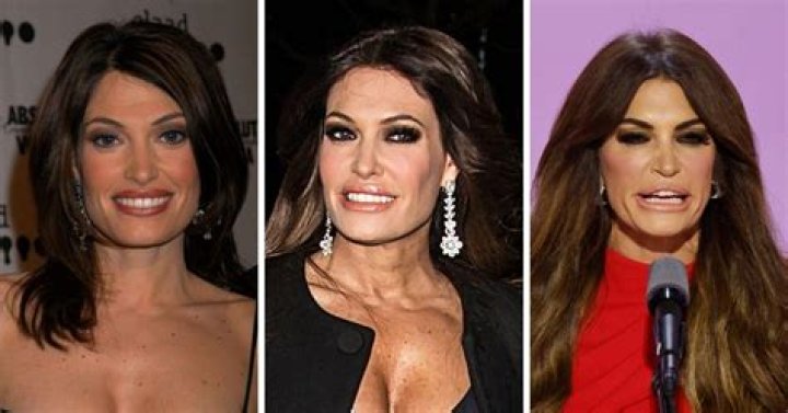 Did Kimberly Guilfoyle Gain Weight Or Is She Pregnant? Details On Her Plastic Surgery And Why She Looks So Different
