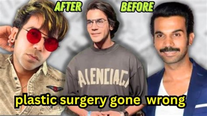 Did Rajkumar Rao Have Face Surgery? Chin Implants Rumors
