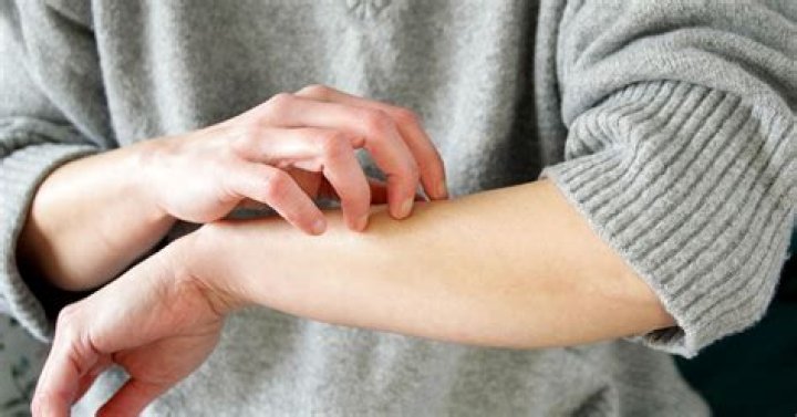 Do leukemia rashes itch?