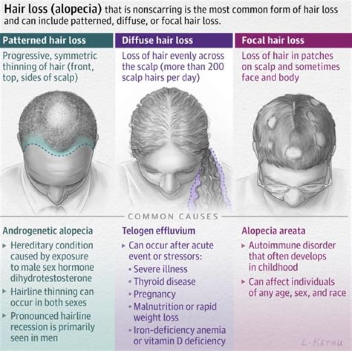 Does alcoholism cause hair loss?