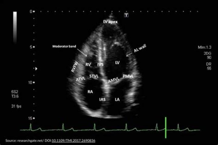 Does an echocardiogram show everything?