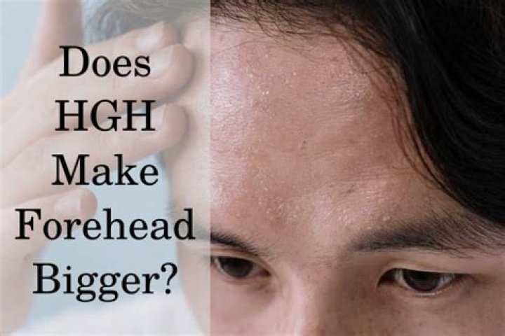 Does hgh cause roid rage?