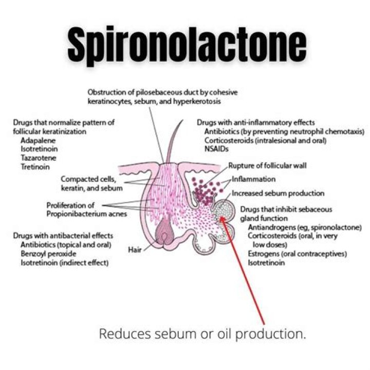 Does spironolactone help acne?