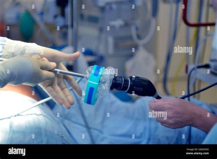 During laparoscopic gastric bypass?