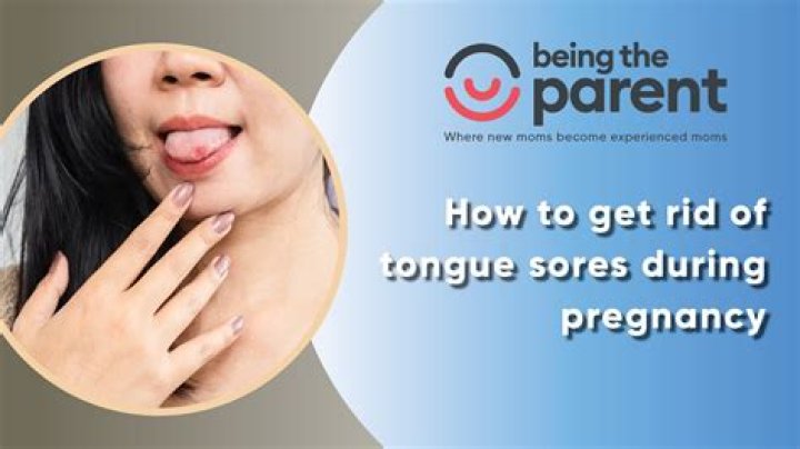 During pregnancy taste buds?