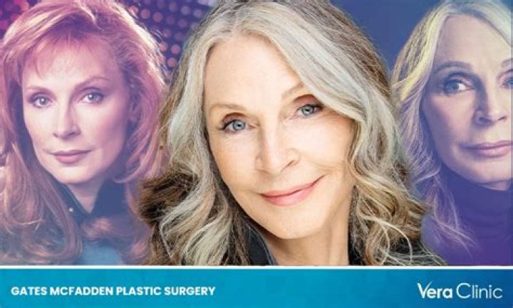 Gates Mcfadden Plastic Surgery Details – Everything We Know About The Actres