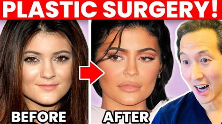 
Has Ana Barbara Had Plastic Surgery? Who is Ana Barbara? 