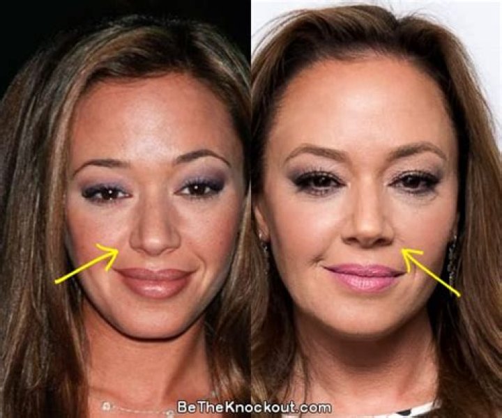 Has Leah Remini Had Plastic Surgery? What Happened To Her Face?