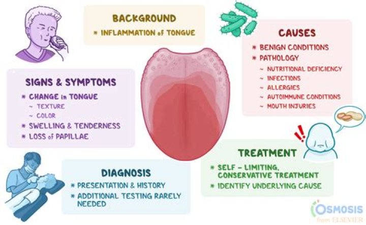 How can glossodynia be treated?