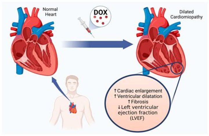 How does doxorubicin affect the heart?
