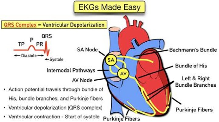 In an ecg the ventricles contract when they depolarize?