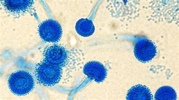 Is spermatorrhea a disease?