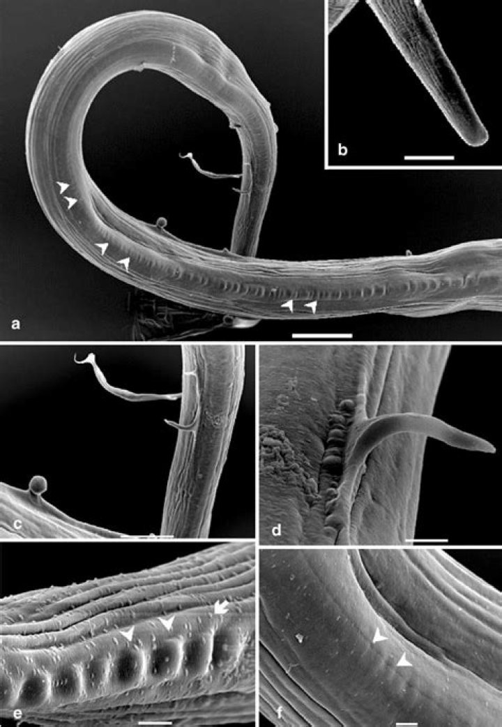 Is wuchereria bancrofti a nematode?