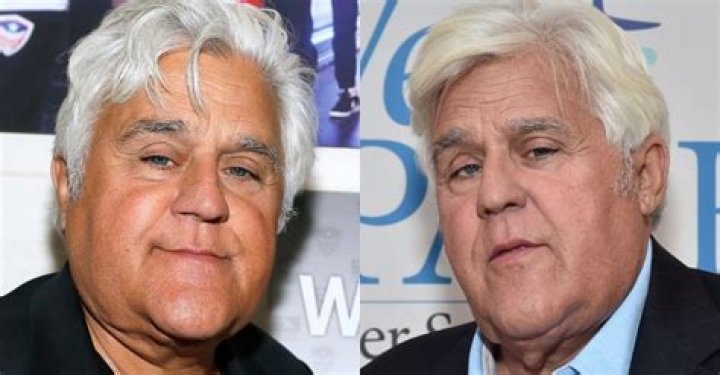 
Jay Leno Teases That His ‘Brand New Face’ Is ‘Better Than What Was There Before’ Accident 