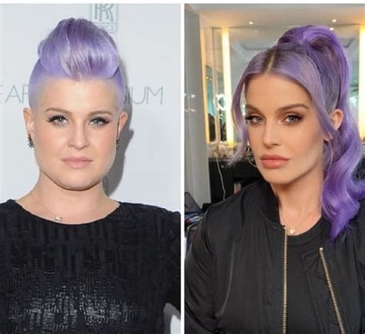 Kelly Osbourne Before And After Plastic Surgery, Age And Husband