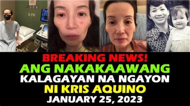 
Kris Aquino Latest News 2022 Today- How Is She Doing? Health Update 