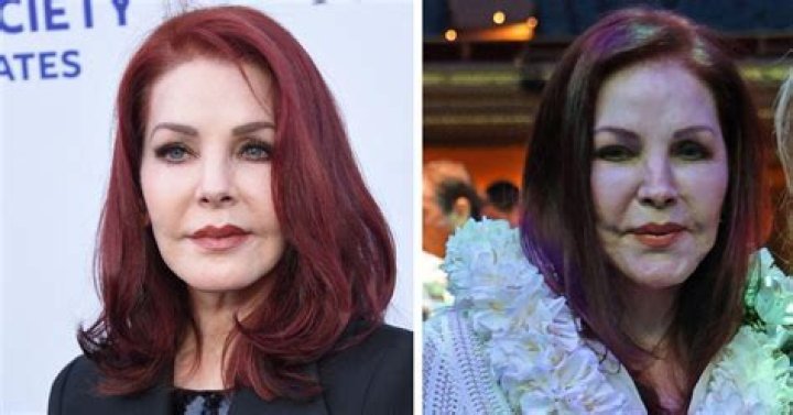 
Linda Evangelista’s Plastic Surgery Nightmare: Her Before And After Photos Explored 