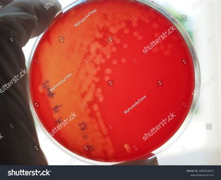 On blood agar plate?
