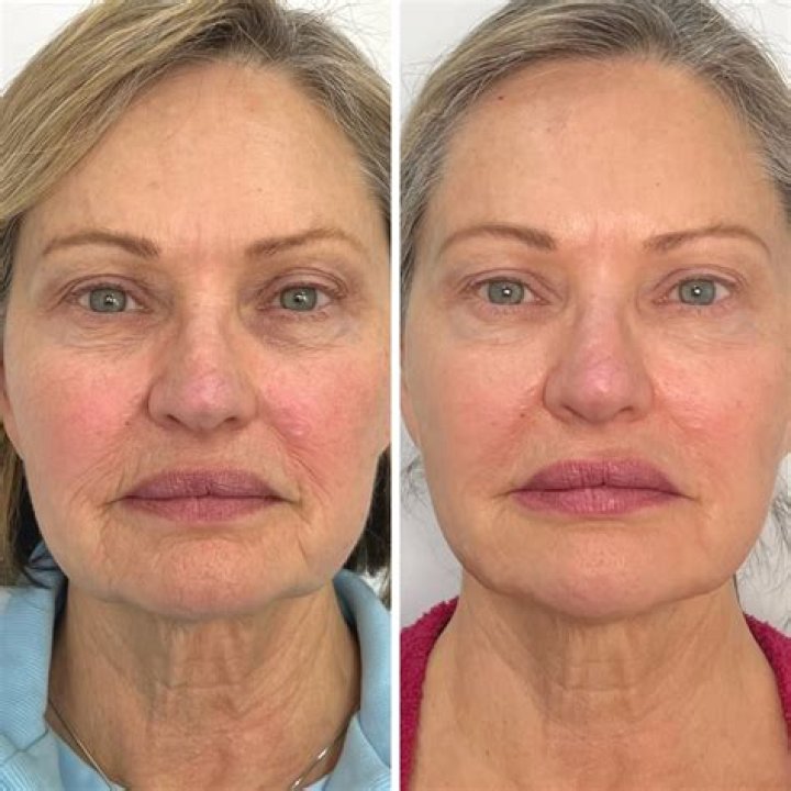 
Peter Aldous Surgery Update, Before and After Pictures – What Happened To Him? 