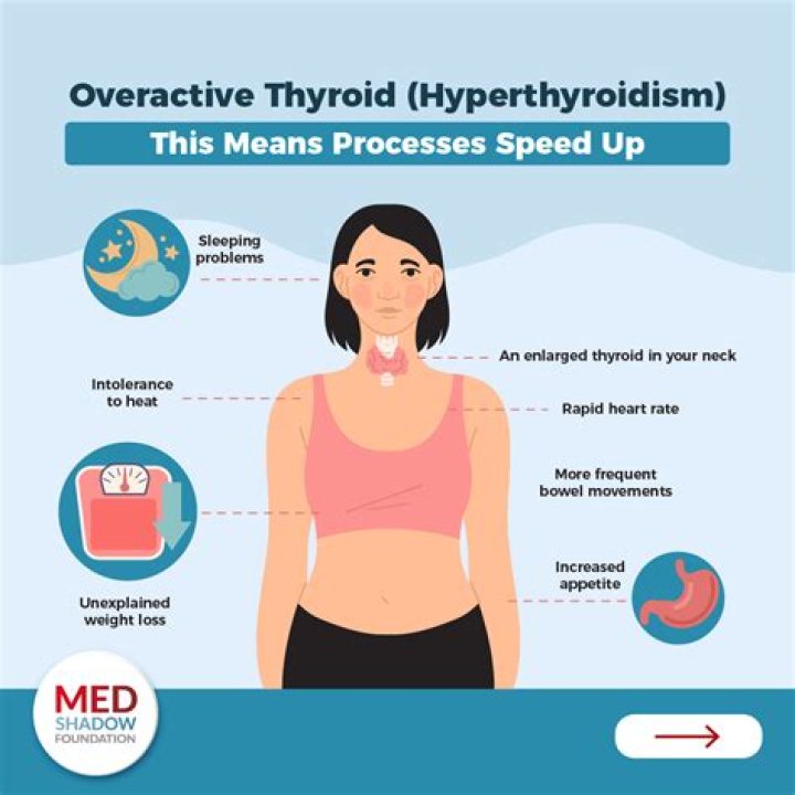 Should mild hyperthyroidism be treated?