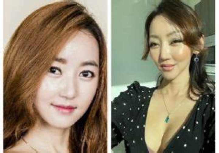Truth About Yeonmi Park’s Surgery Rumors