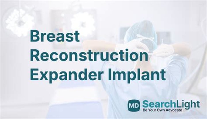 What are expanders for breast surgery?