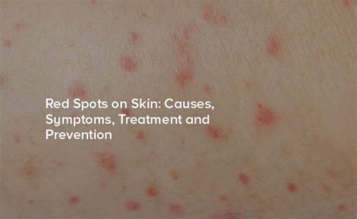 What are red patches on skin?
