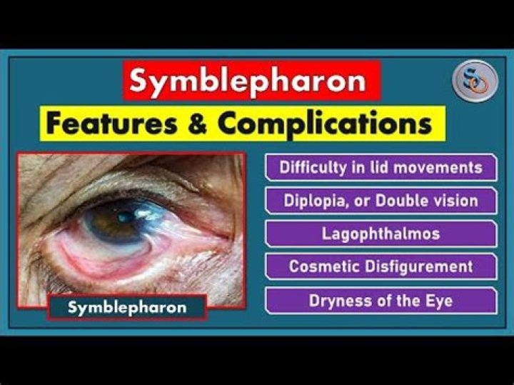 What does ankyloblepharon mean?