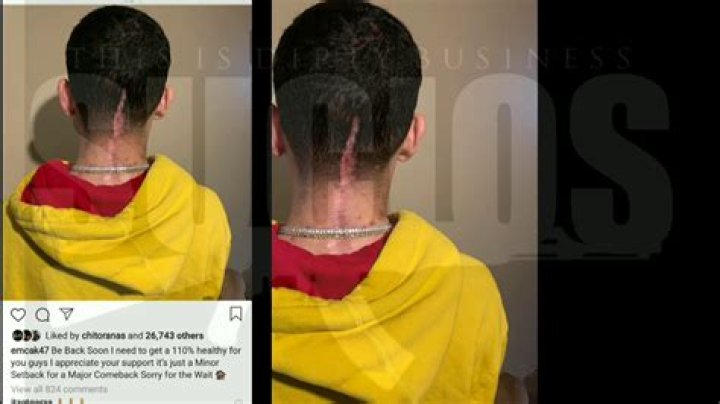 What Happened To Emc Senatra? Car Accident That Broke His Neck and Skull