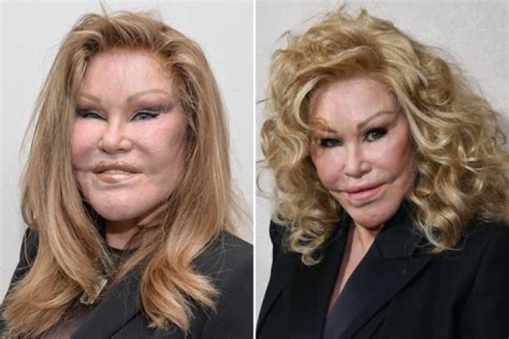 What Happened To Jocelyn Wildenstein Face? Before And After Plastic Surgery – Young Photos