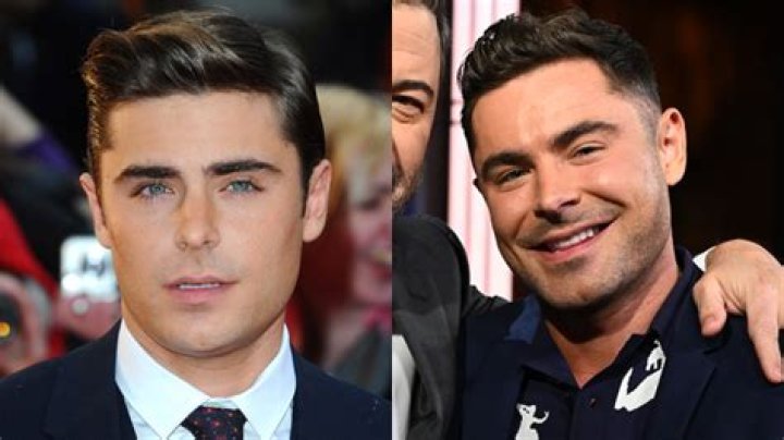 What Happened To Zac Efron Face After Car Accident: Jaw Injury Update, Before & After Plastic Surgery
