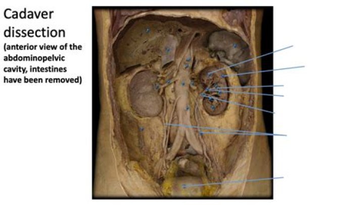 What happens to cadavers after dissection?