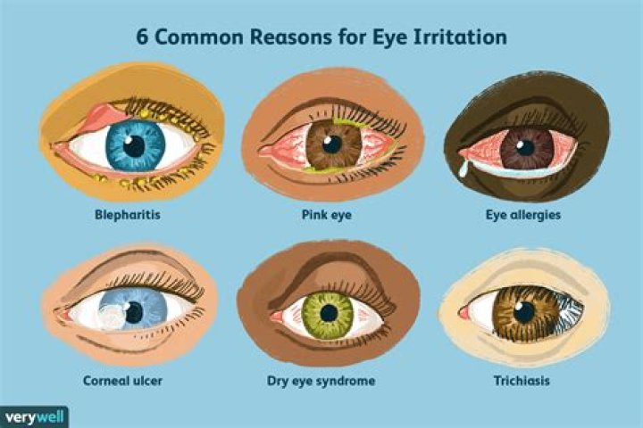 What is eye irritation?