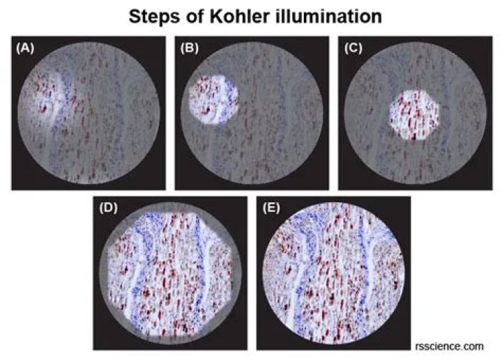 What is kohler illumination?