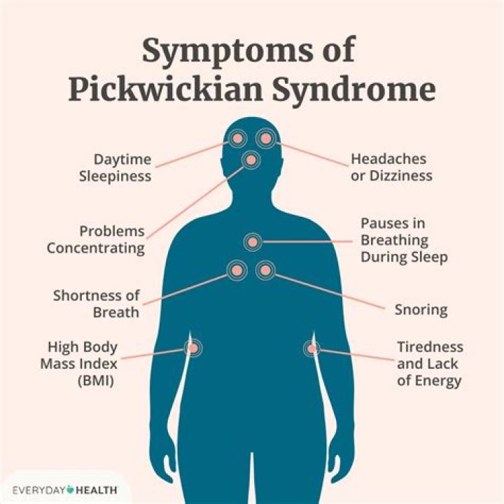 What is pickwickian syndrome?