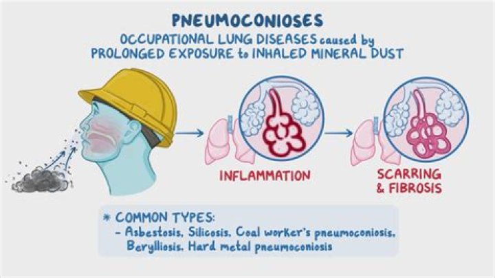 What is pneumoconiosis how does it occur?