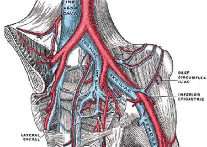 Where is the iliofemoral artery located?